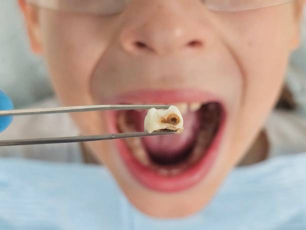 Best Urgent Dental Care  in Caryville, TN